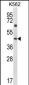 KRT12 Antibody (C-term)